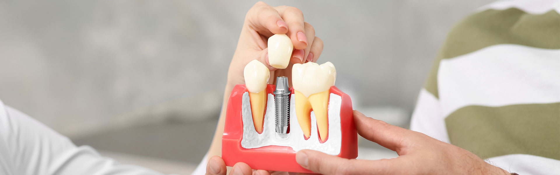 Why Is My Dental Implant Throbbing? 6 Possible Reasons