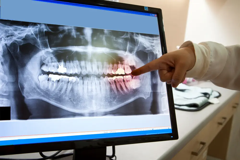 Advanced Technology at Elite Dental