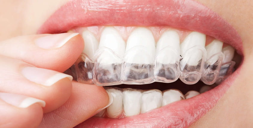 Orthodontic Care